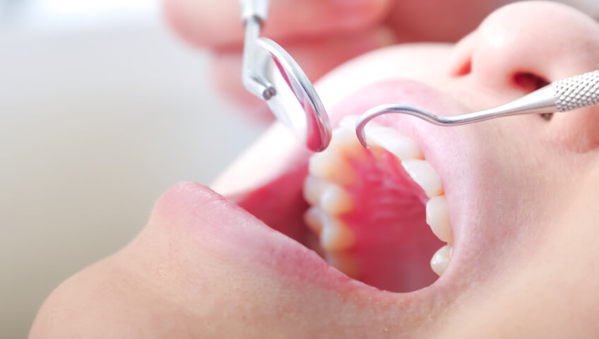 ③前準備としての治療