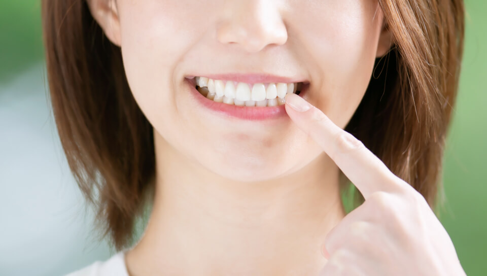 精度・きれいな見た目