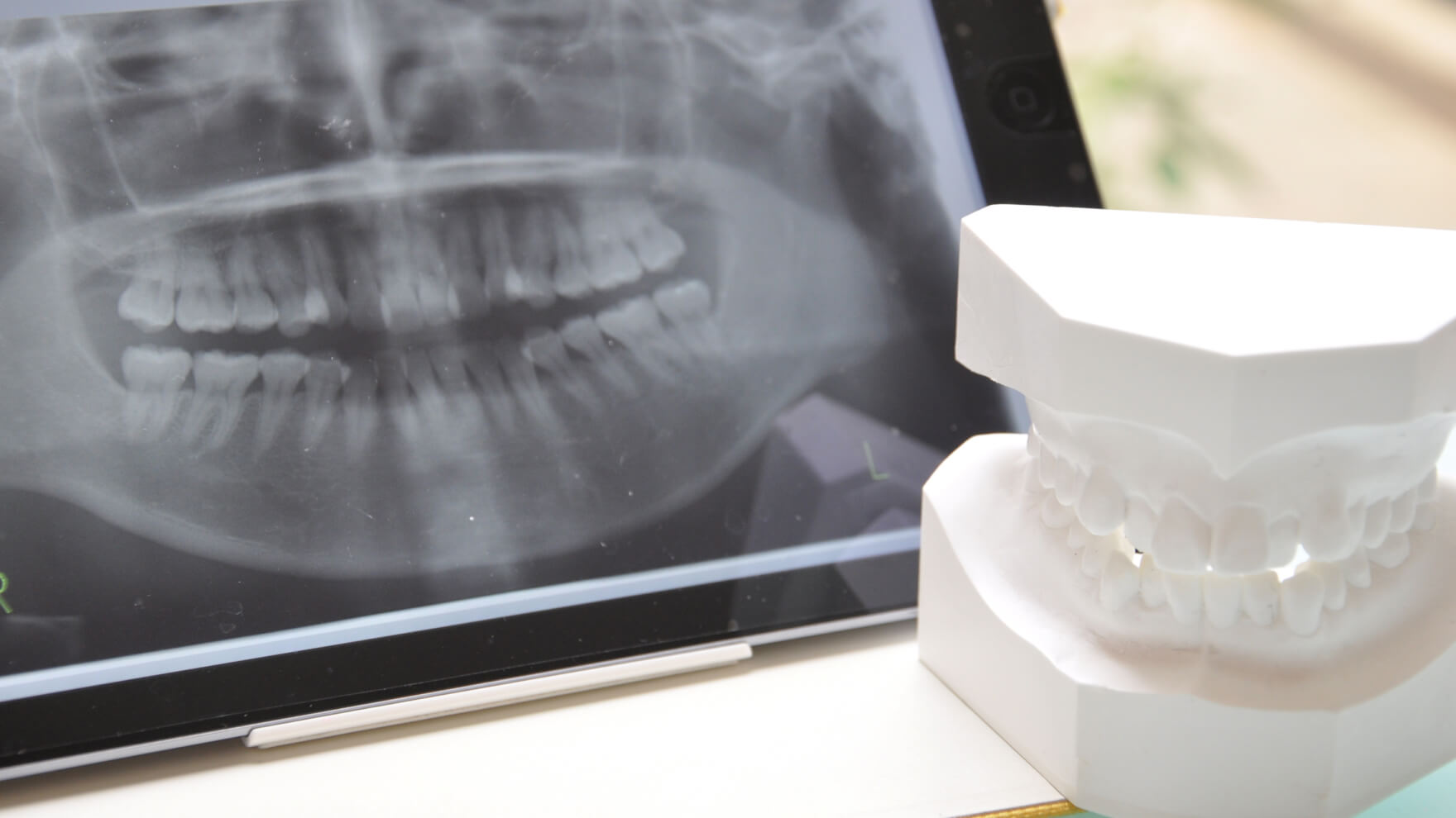 安藤歯科医院における歯科口腔外科について